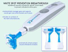 30 Second Smile ORTHODONTIC Electric Toothbrush (For people with Braces)  PLEASE CALL 888-813-6631 FOR INFO OR EMAIL INFO@30SECONDSMILE.COM
